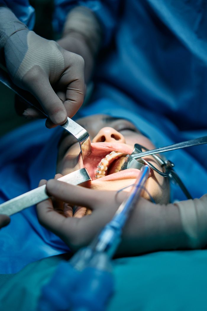team-01 Close-up of dental surgery with medical professionals performing a procedure.